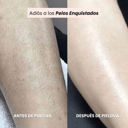 Afeitadora Pielova®