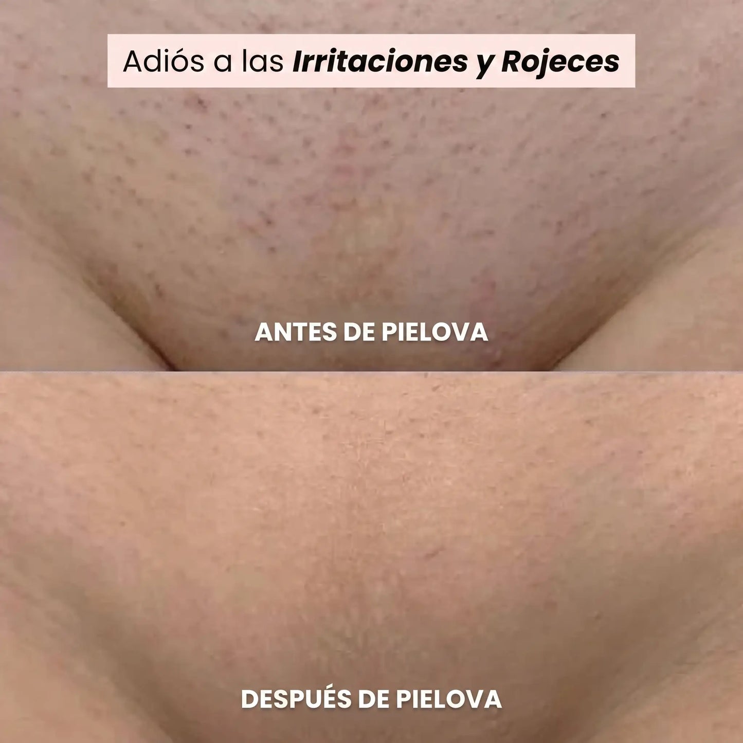 Afeitadora Pielova®